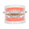 Hip-hop Hipster Big Gold Teeth Braces